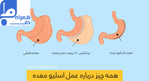 عمل اسلیو 